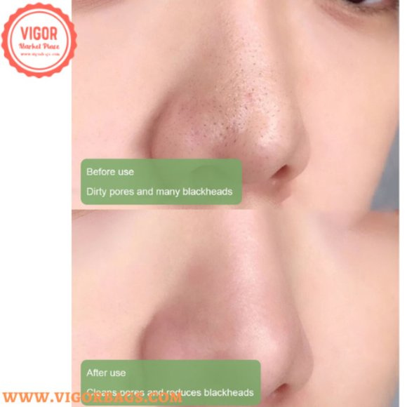 Clay Mask Stick Anti-Acne Deep Cleansing Pores Dirt Moisturizing Hydrating White - Picture 6 of 11